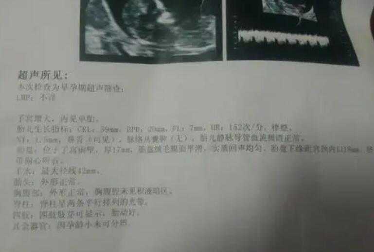 重庆代怀孕成功率高 高龄在重庆做第三代试管婴儿价格多少? ‘四维彩超单男女